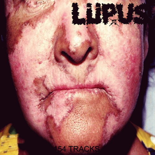 Lupus (BRA) : 154 Tracks